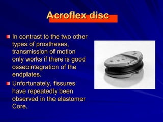 Acroflex disc
In contrast to the two other
types of prostheses,
transmission of motion
only works if there is good
osseointegration of the
endplates.
Unfortunately, fissures
have repeatedly been
observed in the elastomer
Core.
 