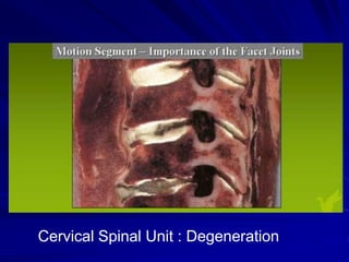 Cervical Spinal Unit : Degeneration
 