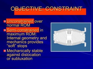 OBJECTIVE: CONSTRAINT
Unconstrained over
normal ROM
Semi-constrained in
maximum ROM:
Internal geometry and
mechanics provides
“soft” stops
Mechanically stable
against dislocation
or subluxation
 