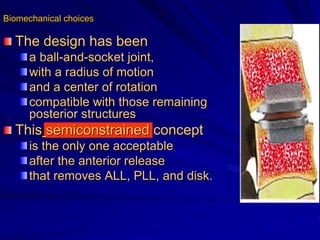 Biomechanical choices
The design has been
a ball-and-socket joint,
with a radius of motion
and a center of rotation
compatible with those remaining
posterior structures
This semiconstrained concept
is the only one acceptable
after the anterior release
that removes ΑLL, ΡLL, and disk.
 