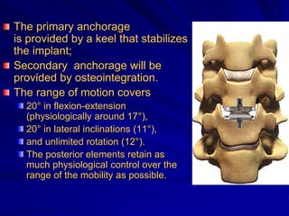The primary anchorage
is provided by a keel that stabilizes
the implant;
Secondary anchorage will be
provίded by osteointegration.
The range of motion covers
20° in flexion-extension
(physiologically around 17°),
20° in lateral inclinations (11°),
and unlimited rotation (12°).
The posterior elements retain as
much physiological control over the
range of the mobility as possible.
 