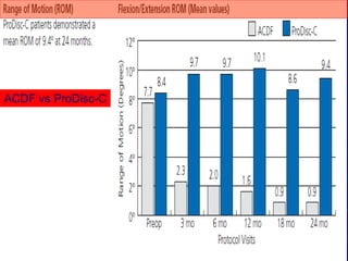 ACDF vs ProDisc-C
 