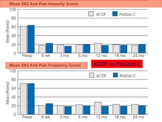 ACDF vs ProDisc-C
 