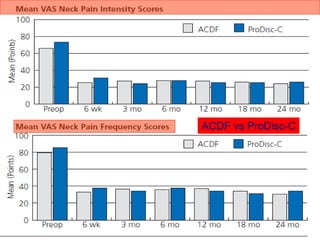 ACDF vs ProDisc-C
 