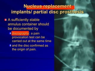 Nucleus replacement
implants/ partial disc prosthesis
A sufficiently stable
annulus container should
be documented by
discography; a pain
provocation test can be
carried out at the same time
and the disc confirmed as
the origin of pain.
 