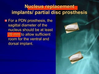 Nucleus replacement
implants/ partial disc prosthesis
For a PDN prosthesis, the
sagittal diameter of the
nucleus should be at least
26 mm to allow sufficient
room for the ventral and
dorsal implant.
 