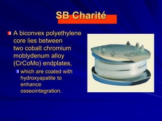 SB Charité
A biconvex polyethylene
core lies between
two cobalt chromium
moblydenum alloy
(CrCoMo) endplates,
which are coated with
hydroxyapatite to
enhance
osseointegration.
 
