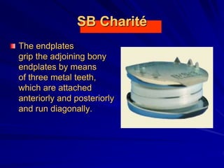 SB Charité
The endplates
grip the adjoining bony
endplates by means
of three metal teeth,
which are attached
anteriorly and posteriorly
and run diagonally.
 