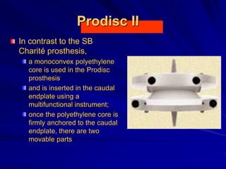 Prodisc II
In contrast to the SB
Charité prosthesis,
a monoconvex polyethylene
core is used in the Prodisc
prosthesis
and is inserted in the caudal
endplate using a
multifunctional instrument;
once the polyethylene core is
firmly anchored to the caudal
endplate, there are two
movable parts
 