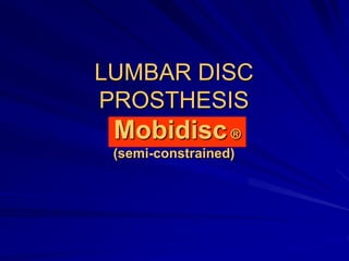 LUMBAR DISC
PROSTHESIS
Mobidisc®
(semi-constrained)
 