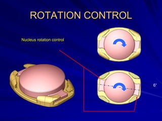 ROTATION CONTROL
Nucleus rotation control
6°
 