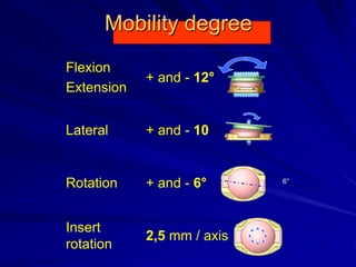 Mobility degree
Flexion
Extension
+ and - 12°
Lateral + and - 10
Rotation + and - 6°
Insert
rotation
2,5 mm / axis
6°
 