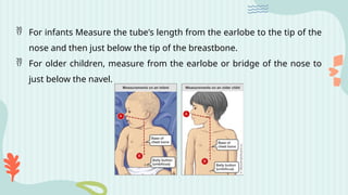  For infants Measure the tube's length from the earlobe to the tip of the
nose and then just below the tip of the breastbone.
 For older children, measure from the earlobe or bridge of the nose to
just below the navel.
 