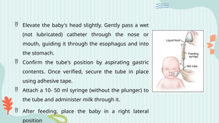  Elevate the baby's head slightly. Gently pass a wet
(not lubricated) catheter through the nose or
mouth, guiding it through the esophagus and into
the stomach.
 Confirm the tube's position by aspirating gastric
contents. Once verified, secure the tube in place
using adhesive tape.
 Attach a 10- 50 ml syringe (without the plunger) to
the tube and administer milk through it.
 After feeding, place the baby in a right lateral
position
 