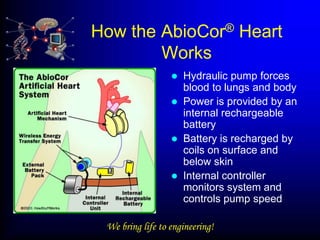 How the AbioCor® Heart
        Works
                     Hydraulic pump forces
                      blood to lungs and body
                     Power is provided by an
                      internal rechargeable
                      battery
                     Battery is recharged by
                      coils on surface and
                      below skin
                     Internal controller
                      monitors system and
                      controls pump speed

 We bring life to engineering!
 