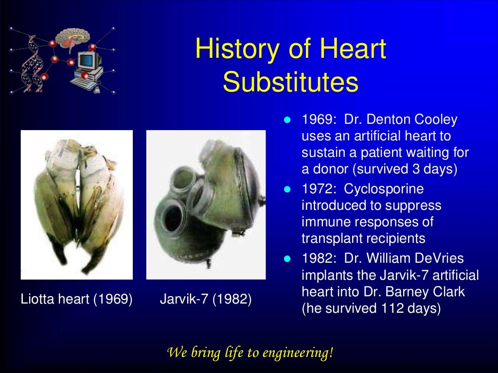 Artificial heart