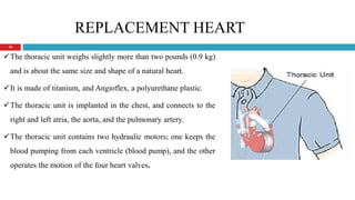 Artificial Heart medical final powerpoint | PPT