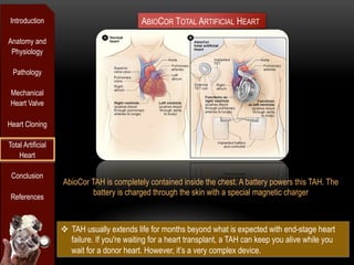 Introduction                                 ABIOCOR TOTAL ARTIFICIAL HEART
Anatomy and
 Physiology

 Pathology

 Mechanical
 Heart Valve

Heart Cloning

Total Artificial
    Heart

 Conclusion
                   AbioCor TAH is completely contained inside the chest. A battery powers this TAH. The
 References
                            battery is charged through the skin with a special magnetic charger



                   v  TAH usually extends life for months beyond what is expected with end-stage heart
                       failure. If you're waiting for a heart transplant, a TAH can keep you alive while you
                       wait for a donor heart. However, it’s a very complex device.
 