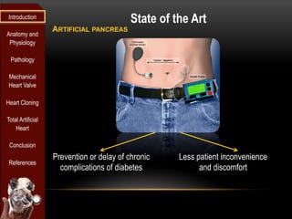 Introduction
                                           State of the Art
                   ARTIFICIAL PANCREAS
Anatomy and
 Physiology

 Pathology

 Mechanical
 Heart Valve

Heart Cloning

Total Artificial
    Heart

 Conclusion
                   Prevention or delay of chronic    Less patient inconvenience
 References
                     complications of diabetes             and discomfort
 