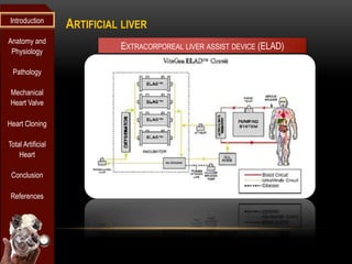 Introduction
                   ARTIFICIAL LIVER
Anatomy and
 Physiology
                             EXTRACORPOREAL LIVER ASSIST DEVICE (ELAD)

 Pathology

 Mechanical
 Heart Valve

Heart Cloning

Total Artificial
    Heart

 Conclusion

 References
 