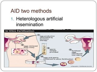 AID two methods
1. Heterologous artificial
   insemination
2. Heterologous IVF and ET
 