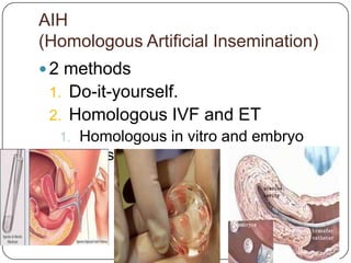 AIH
(Homologous Artificial Insemination)
 2 methods
 1. Do-it-yourself.
 2. Homologous IVF and ET
   1. Homologous in vitro and embryo
      transfer
 