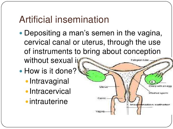 Artificial insemination