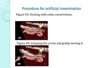 Procedure for artificial insemination
Figure #3: Dealing with colon constrictions.
Figure #4: Grasping the cervix and gently moving it
forward
 