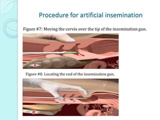 Procedure for artificial insemination
Figure #7: Moving the cervix over the tip of the insemination gun.
Figure #8: Locating the end of the insemination gun.
 