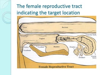The female reproductive tract
indicating the target location
 