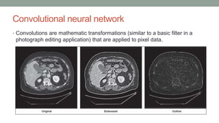 Convolutional neural network
• Convolutions are mathematic transformations (similar to a basic filter in a
photograph editing application) that are applied to pixel data.
 