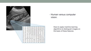 • Human versus computer
vision.
Have to apply machine learning
algorithms to distinguish images on
the basis of these features
 