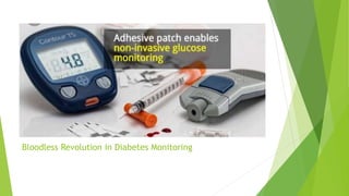 Bloodless Revolution in Diabetes Monitoring
 