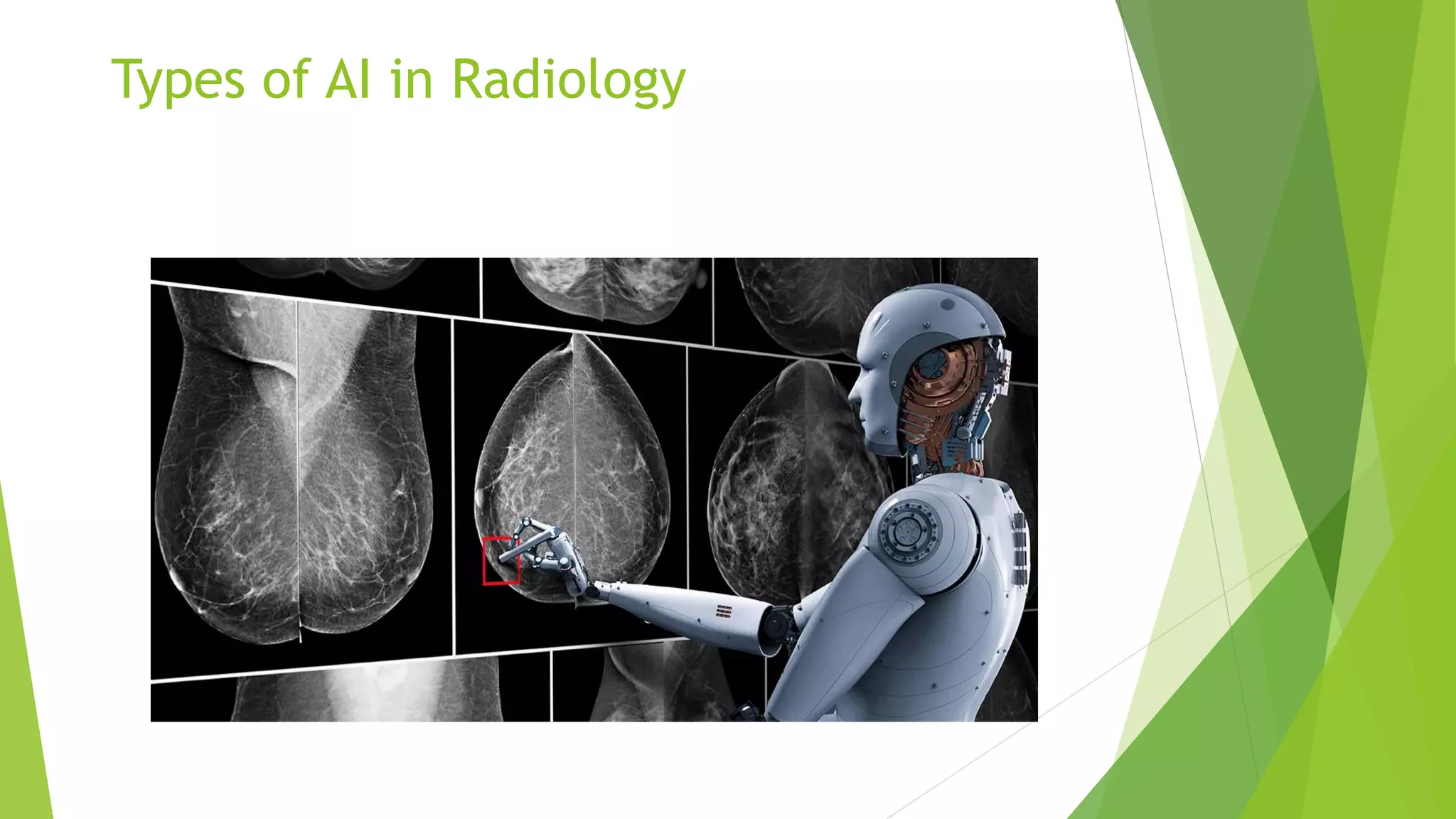 Types of AI in Radiology
 