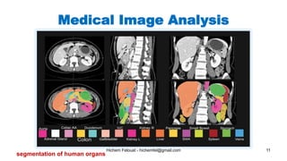 Hichem Felouat - hichemfel@gmail.com 11
Medical Image Analysis
segmentation of human organs
 