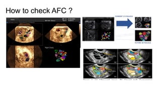 How to check AFC ?
 