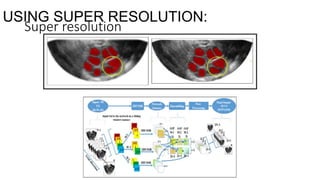USING SUPER RESOLUTION:
Super resolution
 