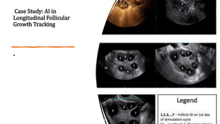 Case Study: AI in
Longitudinal Follicular
Growth Tracking
•
 
