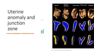 Uterine
anomaly and
junction
zone
 