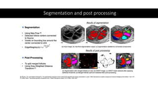 Segmentation and post processing
 