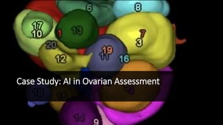 Case Study: AI in Ovarian Assessment
 