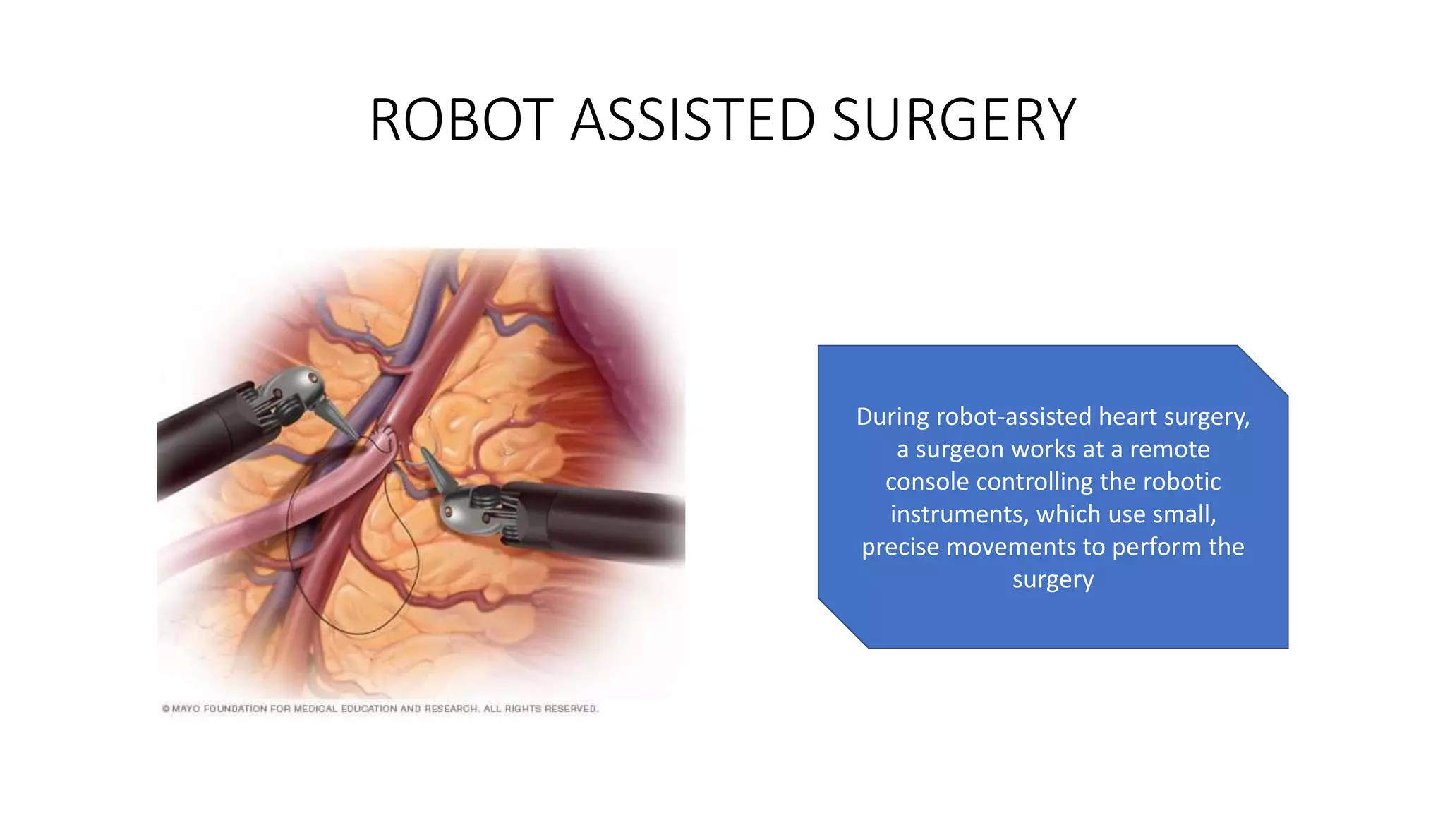 ROBOT ASSISTED SURGERY
During robot-assisted heart surgery,
a surgeon works at a remote
console controlling the robotic
instruments, which use small,
precise movements to perform the
surgery
 
