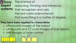 Fuzzy
expert
systems
The science of
reasoning, thinking and inference
that recognizes and uses
the real world phenomenon
that everything is a matter of degree
They have been applied to characterize
• ultrasound images of the breast
• ultrasound and CT scan images of liver lesions
• MRI images of brain tumors
 