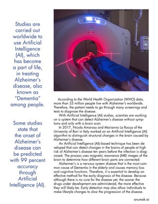 Artificial Intelligence To Diagnose Alzheimer's Early | PDF