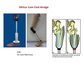 Africa: Low Cost design

ICRC
Int. Com Red Cross

 