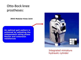Otto-Bock knee
prostheses:
3R45 Modular Knee Joint

An optimal gait pattern is
achieved by adjusting the
independent swing phase
flexion and extension
resistances

Integrated miniature
hydraulic cylinder

 