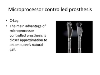 Microprocessor controlled prosthesis
• C-Leg
• The main advantage of
microprocessor
controlled prosthesis is
closer approximation to
an amputee’s natural
gait

 