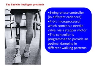 The Endolite intelligent prosthesis

•Swing-phase controller
(in different cadences)
•4-bit microprocessor
which controls a needle
valve, via a stepper motor
•The controller is
programmed to provide an
optimal damping in
different walking patterns.

 