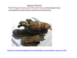 Egyptian Mummy:
The 5th Egyptian Dynasty (2750-2625 B.C.); archaeologists have
unearthed the oldest known splint from that period.

Image source: http://www.egyptarchive.co.uk/html/hidden_treasures/hidden_treasures_31.html

 