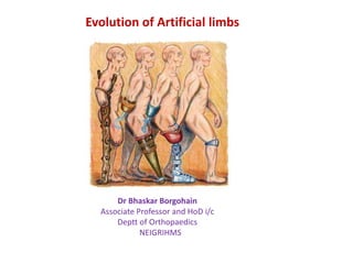 Evolution of Artificial limbs

Dr Bhaskar Borgohain
Associate Professor and HoD i/c
Deptt of Orthopaedics
NEIGRIHMS

 